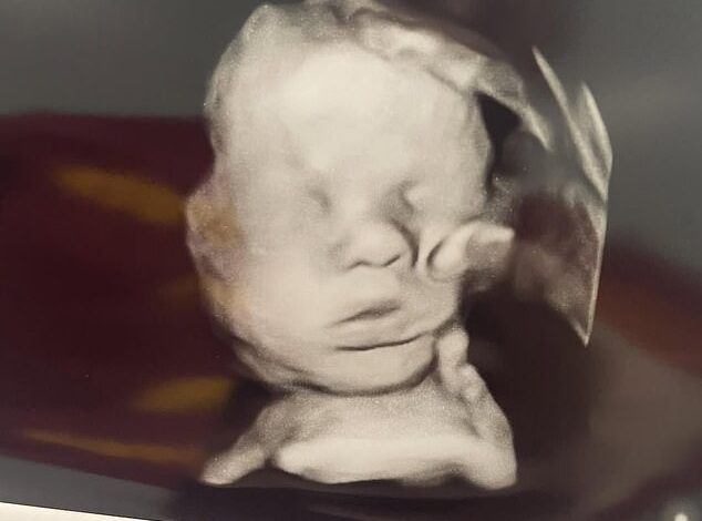 "Miraculous ‘Hand of God’ in Ultrasound Answers Mother’s Health Prayer"