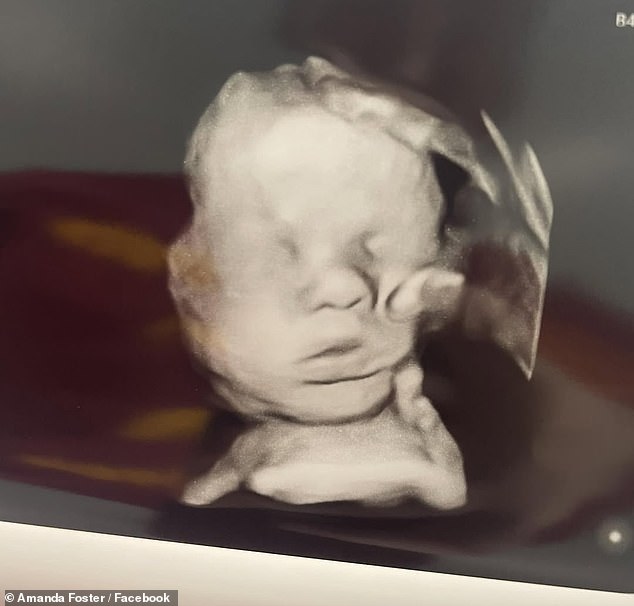 "Miraculous ‘Hand of God’ in Ultrasound Answers Mother’s Health Prayer"