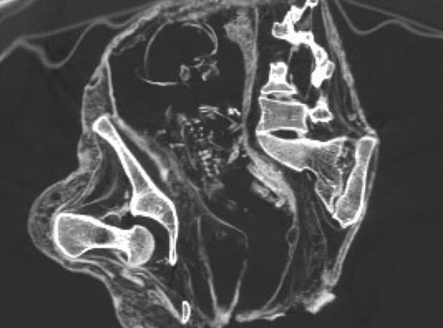 Scientists Examining ‘Alien-Linked’ Mummies Unearth Startling Fetal Structure in Ancient Corpse