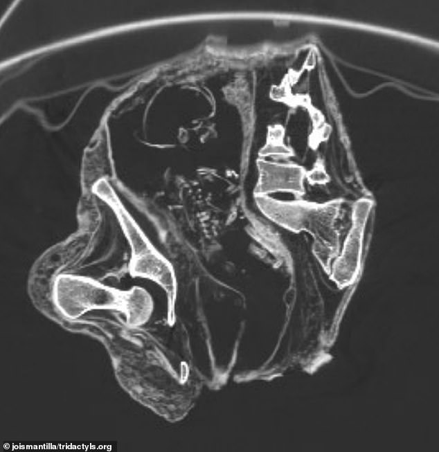 Scientists Examining ‘Alien-Linked’ Mummies Unearth Startling Fetal Structure in Ancient Corpse