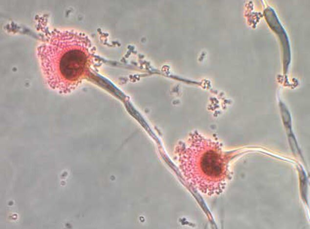 Deadly Internal-Eroding Fungus Spreads Across US, Threatening Hundreds of Thousands of Lives