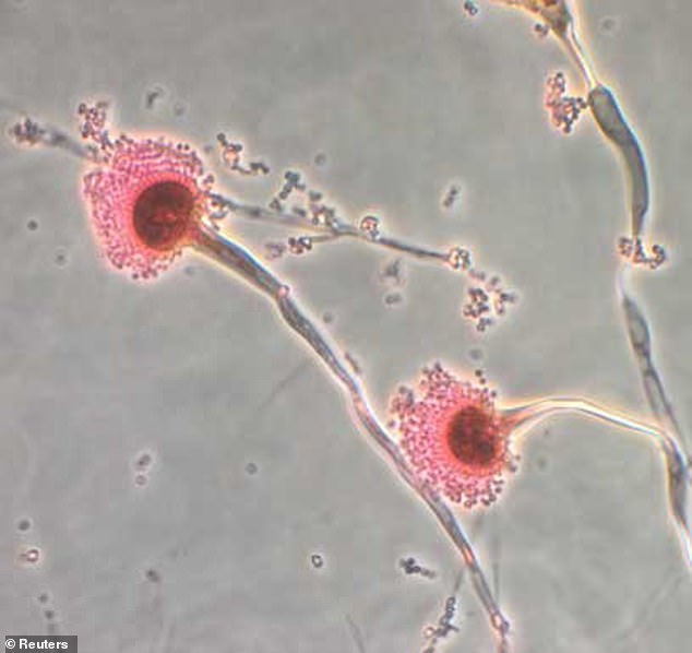 Deadly Internal-Eroding Fungus Spreads Across US, Threatening Hundreds of Thousands of Lives