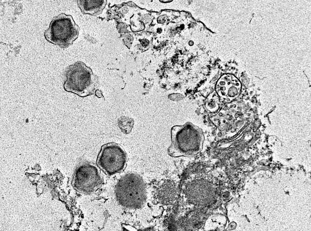 Scientists Uncover Hundreds of Mysterious Giant Viruses in Ocean Depths
