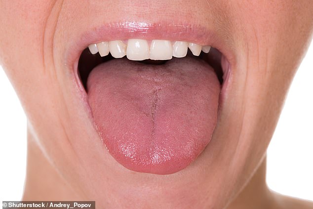 Science Explains What Your Tongue Reveals About Your Health