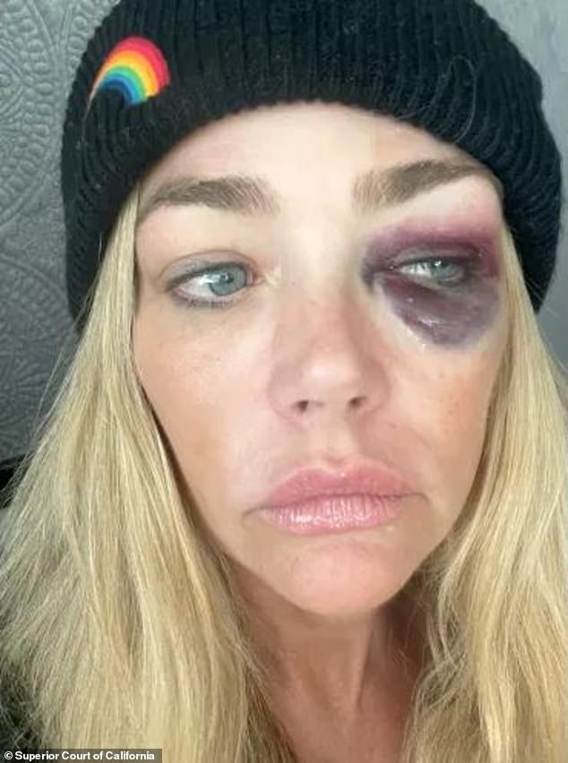 Denise Richards Accuses Aaron Phypers of Physical Abuse, Death Threats in Court Documents
