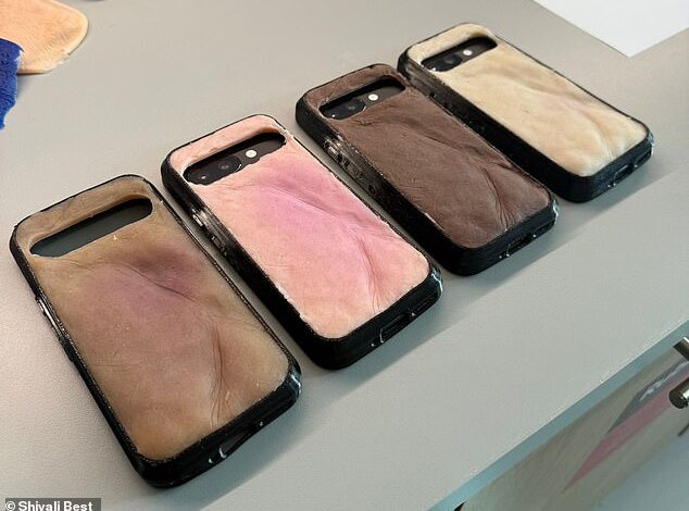 Creepy ‘Burner Phone’ Case with Fake Skin Burns Like Human Flesh Under UV