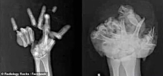 Urgent Warnings: X-Rays Reveal Hidden Dangers in Americans’ Planned Activities Tomorrow