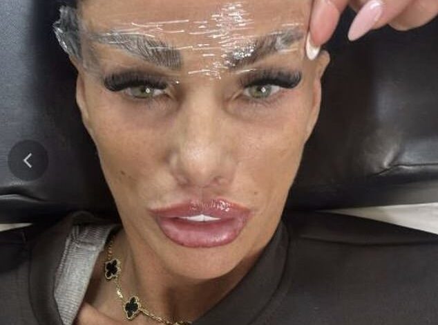 Katie Price Sparks Concern After Revealing Overnight A&E Stay